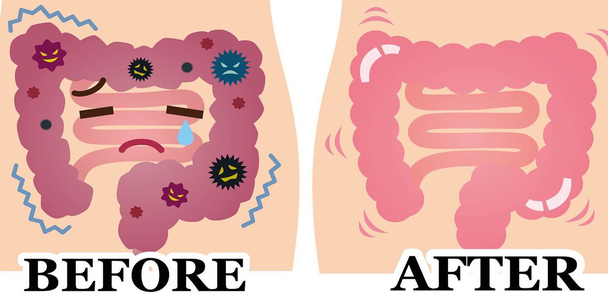 PARASITE CLEANSE Advanced Cleanse and Digestive Supplement, Intestinal Support 2 oz.