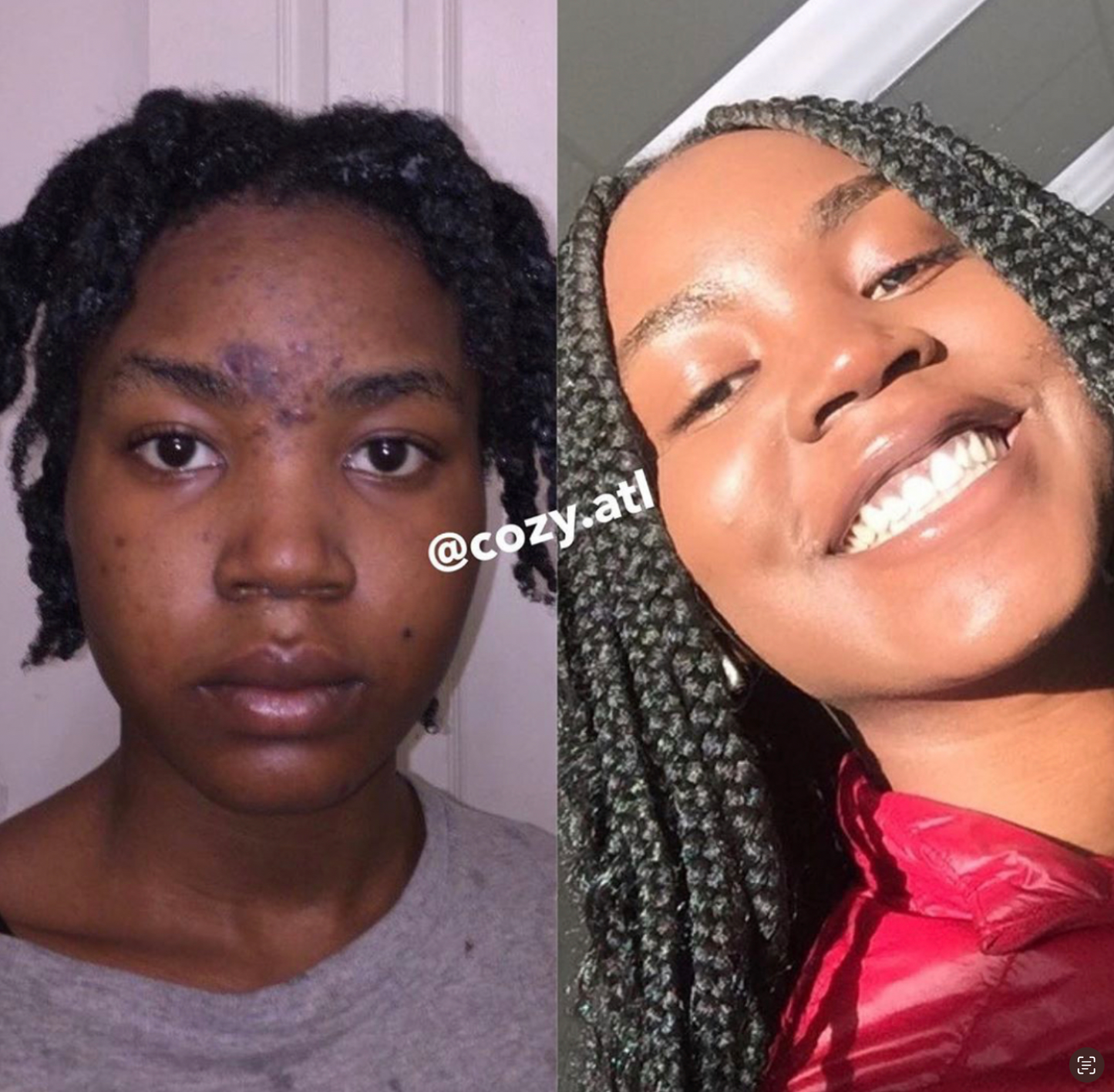 Rain Dance™ Daily Moisturizer + African Detox Soap Bundle