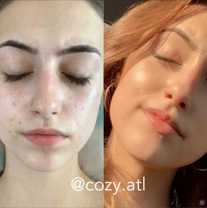 Rain Dance™ Daily Moisturizer + African Detox Soap Bundle