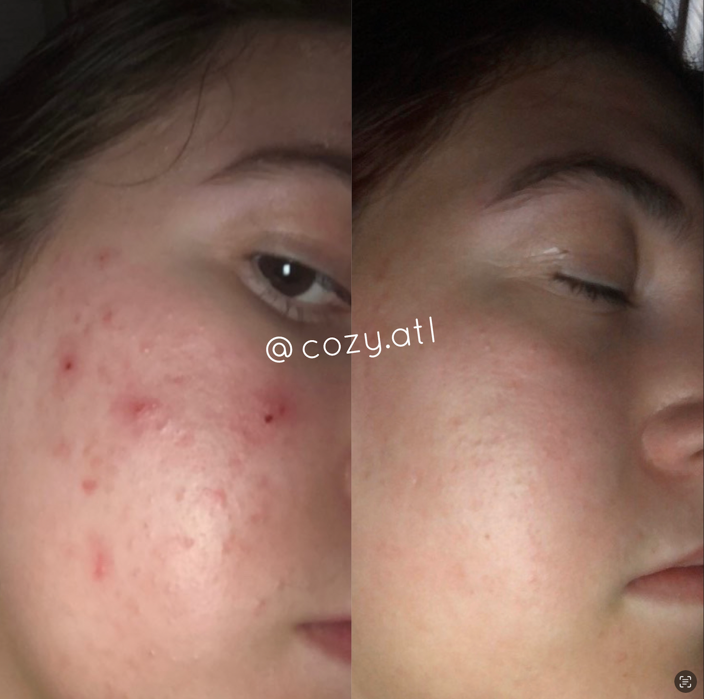 Rain Dance™ Daily Moisturizer + African Detox Soap Bundle